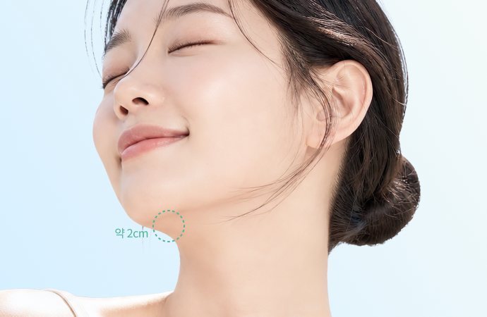  이중턱 근육묶기