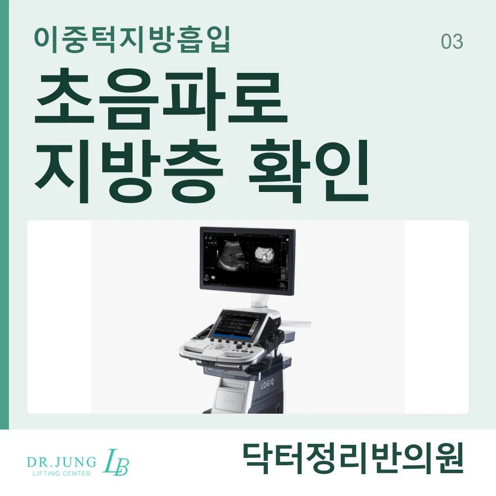 이중턱지방흡입 전 초음파를 통한 지방층 확인 안내