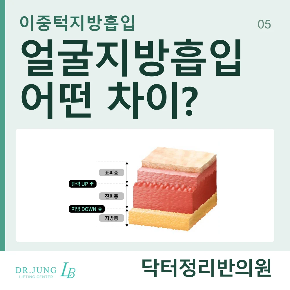 얼굴지방흡입과 이중턱지방흡입의 대상 부위 차이 안내