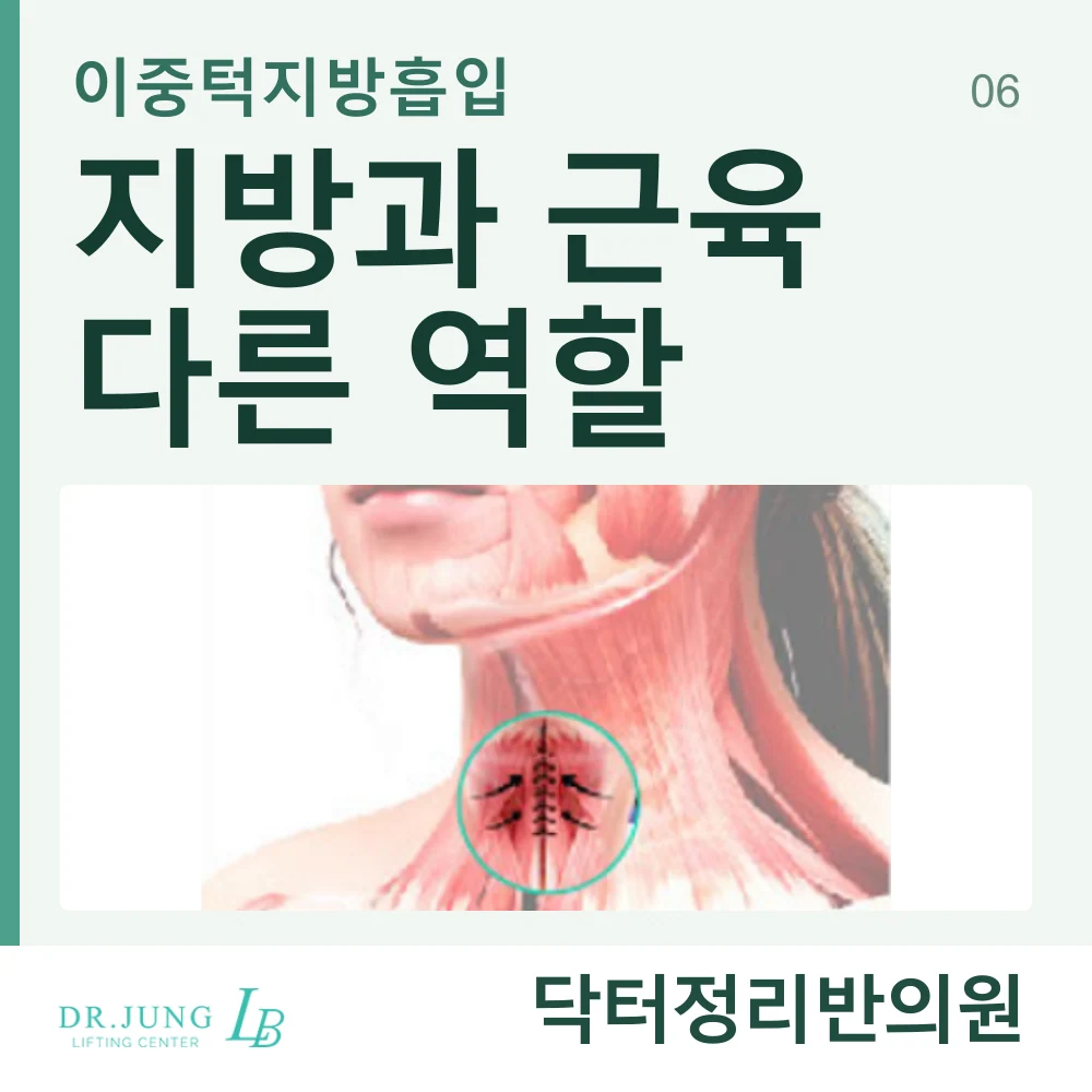 이중턱지방흡입과 활경근을 고정하는 근육묶기의 차이 안내